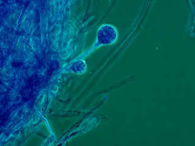 Fungus