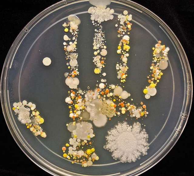 Микроби от отпечатъка на 8 годишно момче след игра навън Таша Стърм