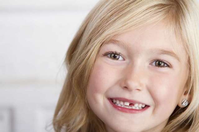 5 неща, които развалят зъбите ви | Диана
