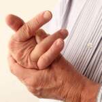 Ревматоидният артрит уврежда ставите дори само за две години