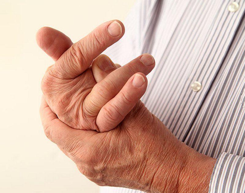 Ревматоидният артрит уврежда ставите дори само за две години | Диана
