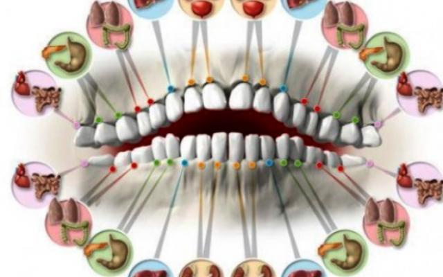 Болките във всеки един зъб са сигурен сигнал за проблем в съответните органи | Диана